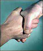 grip